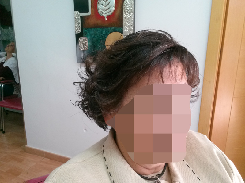 Prótesis de cabello natural