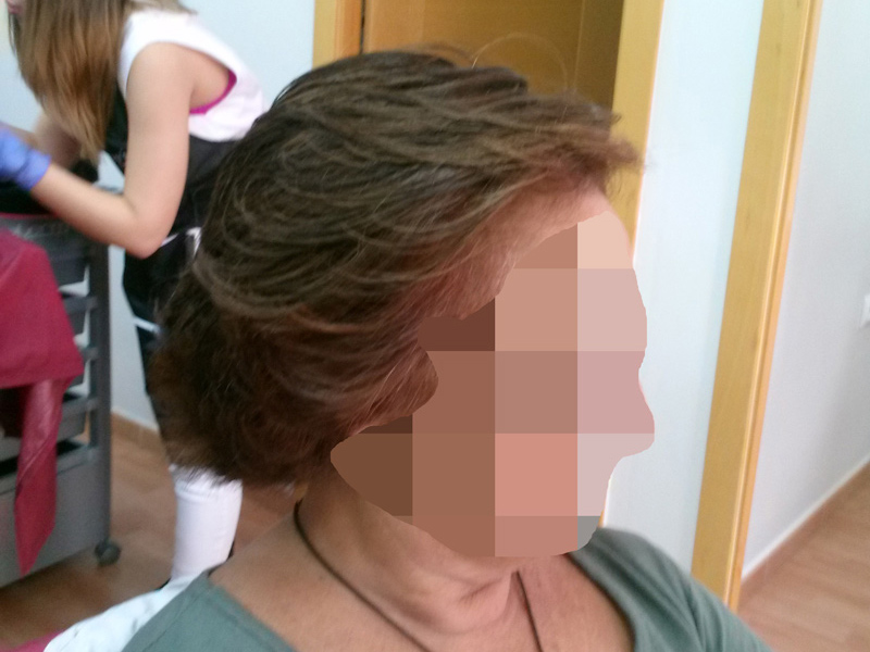 Prótesis de cabello natural