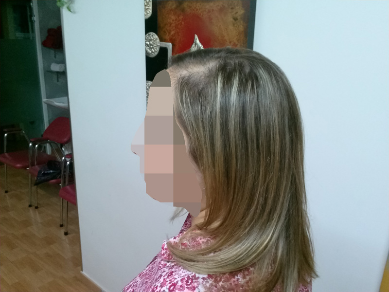 Complemento sintético